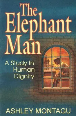 The Elephant Man: A Study in Human Dignity