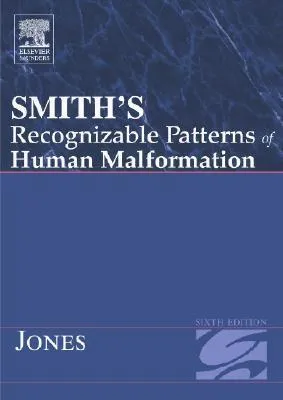 Smith's Recognizable Patterns of Human Malformation